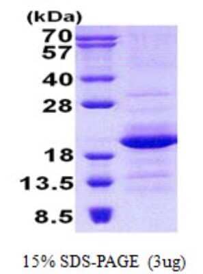 SDS-PAGE Recombinant Human GEMIN6 His Protein