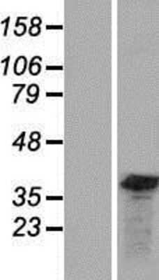 Western Blot: GEMIN8 Overexpression Lysate (Adult Normal) [NBP2-08375] Left-Empty vector transfected control cell lysate (HEK293 cell lysate); Right -Over-expression Lysate for GEMIN8.