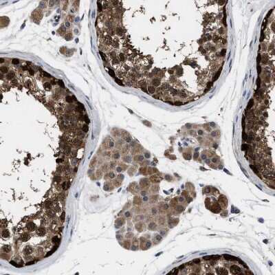 Immunohistochemistry-Paraffin GET4 Antibody