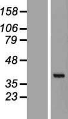 Western Blot GET4 Overexpression Lysate