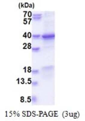 SDS-Page: GET4 Recombinant Protein [NBP2-51574] - 15% SDS Page (3 ug)