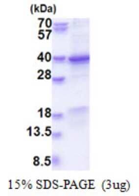 SDS-PAGE Recombinant Human GET4 His Protein