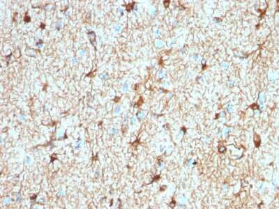 Immunohistochemistry-Paraffin: GFAP Antibody (ASTRO/1974R) - Azide and BSA Free [NBP3-08431] - Formalin-fixed, paraffin-embedded human Cerebellum stained with GFAP Rabbit Recombinant Monoclonal Antibody (ASTRO/1974R).