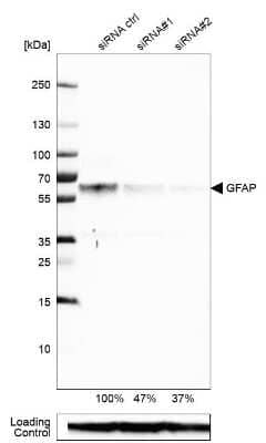 Knockdown Validated: GFAP Antibody (CL2713) [NBP2-76477] - Analysis in U-87MG ATCC cells transfected with control siRNA, target specific siRNA probe #1 and #2, using Anti-GFAP antibody. Remaining relative intensity is presented. Loading control: Anti-GAPDH.