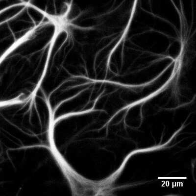 Immunocytochemistry/Immunofluorescence: GFAP Antibody (GA-5) - Azide and BSA Free [NBP2-33184] - Cultured Rat Hippocampal Neurons. ICC/IF image submitted by a verified customer review.