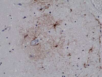 Immunohistochemistry: GFAP Antibody (RM246) [NBP2-77407] - Immunohistochemical staining of formalin fixed and paraffin embedded human brain tissue sections using NBP2-77407.