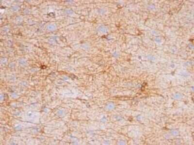 Immunohistochemistry-Paraffin: GFAP Antibody (SPM507) - Azide and BSA Free [NBP2-34413] - Formalin-paraffin human brain stained with GFAP Ab (SPM507). Note cytoplasmic staining.