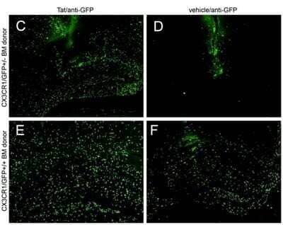 Immunohistochemistry: GFP Antibody (9F9.F9) [Biotin] [NB110-40670] - Used 1:5000 As referenced in: Lu S-M, Tremblay M-E` , King IL, Qi J, Reynolds HM, et al. (2011) HIV-1 Tat-Induced Microgliosis and Synaptic Damage via Interactions between Peripheral and Central Myeloid Cells. PLoS ONE 6(9): e23915. doi:10.1371/journal.pone.0023915