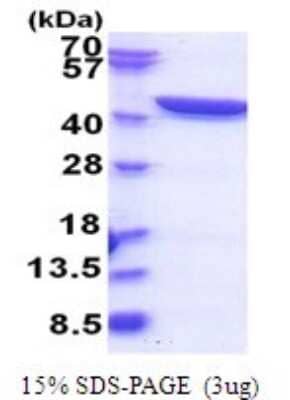 SDS-Page: GFPT1 Recombinant Protein [NBP2-51789] - 15% SDS Page (3 ug)