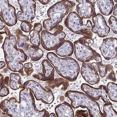 Immunohistochemistry: GFPT2 Antibody [NBP2-38881] - Staining of human placenta shows strong cytoplasmic positivity in trophoblastic cells.