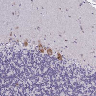 Immunohistochemistry-Paraffin: GFPT2 Antibody [NBP2-38881] - Staining of human cerebellum shows strong granular cytoplasmic positivity in Purkinje cells.