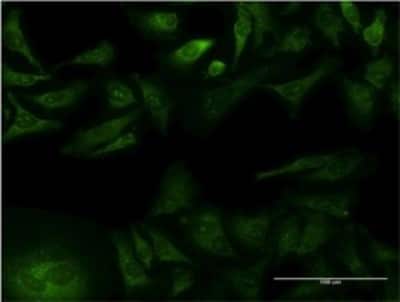 Immunocytochemistry/Immunofluorescence: GFR alpha-1/GDNF R alpha-1 Antibody (1G4) [H00002674-M01] - Analysis of monoclonal antibody to GFRA1 on HeLa cell . Antibody concentration 10 ug/ml.