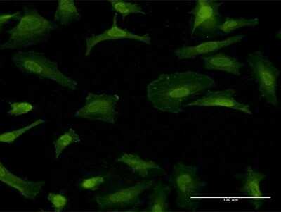 Immunocytochemistry/Immunofluorescence: GFR alpha-1/GDNF R alpha-1 Antibody (4D8) [H00002674-M05] - Analysis of monoclonal antibody to GFRA1 on HeLa cell. Antibody concentration 10 ug/ml