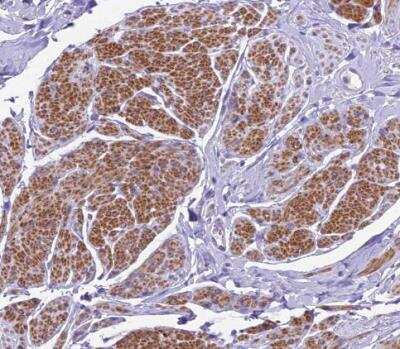 Immunohistochemistry-Paraffin: GFR alpha-1/GDNF R alpha-1 Antibody [NBP2-14045] - Staining of human smooth muscle shows strong granular cytoplasmic positivity in smooth muscle cells.