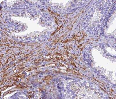 Immunohistochemistry-Paraffin: GFR alpha-1/GDNF R alpha-1 Antibody [NBP2-14045] - Staining of human prostate shows strong granular cytoplasmic positivity in smooth muscle cells.