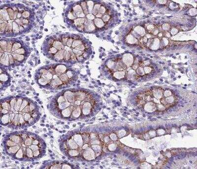 Immunohistochemistry-Paraffin: GFR alpha-1/GDNF R alpha-1 Antibody [NBP2-14045] - Staining of human colon shows moderate granular cytoplasmic positivity in glandular cells.