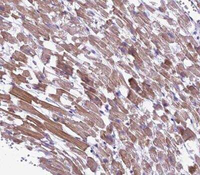 Immunohistochemistry-Paraffin: GFR alpha-1/GDNF R alpha-1 Antibody [NBP2-14045] - Staining of human heart muscle shows moderate cytoplasmic positivity in cardiomyocytes.