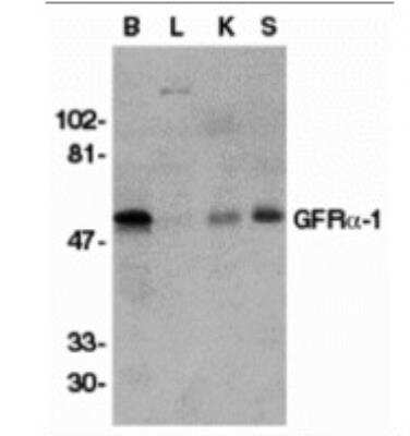 Western Blot: GFR alpha-1/GDNF R alpha-1 Antibody [NBP1-77043] - Analysis of GFR alpha 1 in crude membrane fractions of human brain (B), liver (L), kidney (K), and spleen (S), respectively, with GFR alpha 1 antibody at 1 ug/mL