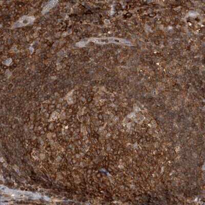 Immunohistochemistry-Paraffin: GFR alpha-2/GDNF R alpha-2 Antibody [NBP1-89778] - Staining of human lymph node shows strong cytoplasmic positivity in reaction center cells and lymphoid cells outside reaction centra.