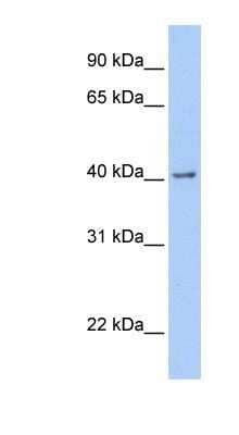 Western Blot: GFR alpha-2/GDNF R alpha-2 Antibody [NBP1-79553] - Human Brain lysate, concentration 0.2-1 ug/ml.