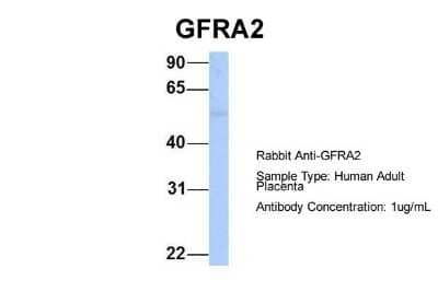 Western Blot: GFR alpha-2/GDNF R alpha-2 Antibody [NBP1-79553] - Human Adult Placenta, Antibody Dilution: 1.0 ug/ml.