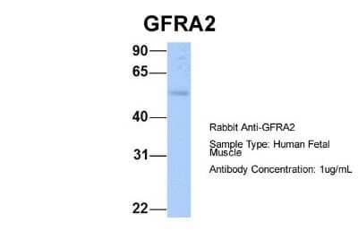 Western Blot: GFR alpha-2/GDNF R alpha-2 Antibody [NBP1-79553] - Human Fetal Muscle, Antibody Dilution: 1.0 ug/ml.