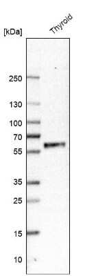 Western Blot: GFR alpha-2/GDNF R alpha-2 Antibody [NBP1-89778] - Analysis in human thyroid gland tissue.