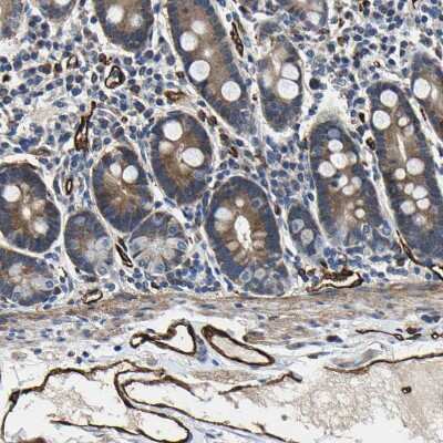 Immunohistochemistry-Paraffin: GFR alpha-3/GDNF R alpha-3 Antibody [NBP1-89774] - Staining of human duodenum shows moderate cytoplasmic positivity in glandular cells.