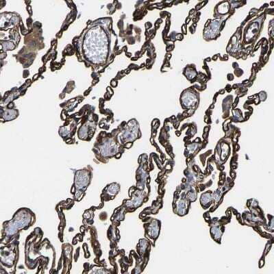 Immunohistochemistry-Paraffin: GFR alpha-3/GDNF R alpha-3 Antibody [NBP1-89774] - Staining of human lung shows strong membranous positivity in pneumocytes.