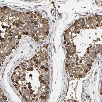 Immunohistochemistry-Paraffin: GFR alpha-3/GDNF R alpha-3 Antibody [NBP1-89774] - Staining of human testis shows strong cytoplasmic positivity in cells in seminiferous ducts.