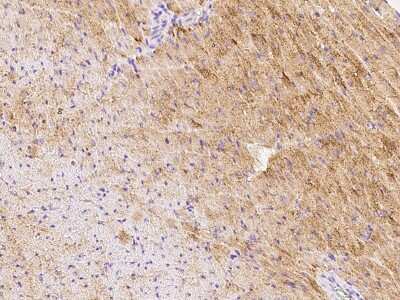 Immunohistochemistry-Paraffin: GFR alpha-3/GDNF R alpha-3 Antibody [NBP2-99437] - Immunochemical staining GFR alpha-3/GDNF R alpha-3 in mouse heart with rabbit polyclonal antibody at 1:500 dilution, formalin-fixed paraffin embedded sections.