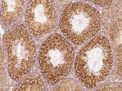 Immunohistochemistry-Paraffin: GFR alpha-3/GDNF R alpha-3 Antibody [NBP2-99437] - Immunochemical staining GFR alpha-3/GDNF R alpha-3 in mouse testis with rabbit polyclonal antibody at 1:500 dilution, formalin-fixed paraffin embedded sections.
