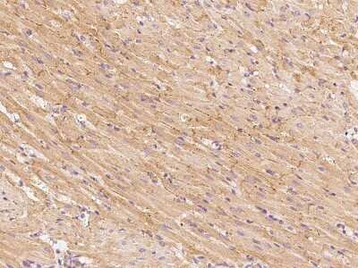 Immunohistochemistry-Paraffin: GFR alpha-3/GDNF R alpha-3 Antibody [NBP2-99437] - Immunochemical staining GFR alpha-3/GDNF R alpha-3 in rat heart with rabbit polyclonal antibody at 1:500 dilution, formalin-fixed paraffin embedded sections.