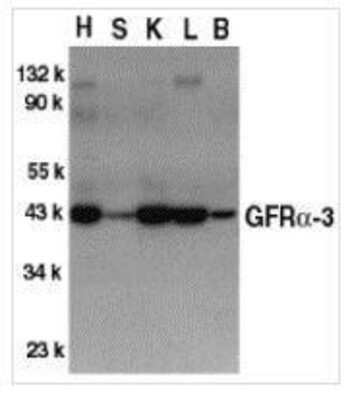 Western Blot: GFR alpha-3/GDNF R alpha-3 Antibody [NBP1-77035] - Crude cell membrane fractions of mouse heart (H), spleen (S), kidney (K), liver (L), and brain (B), respectively, with GFR alpha 3 antibody at 1:500 dilution.
