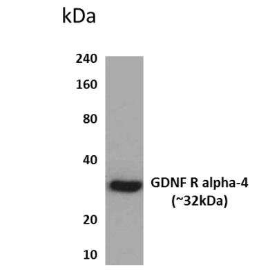 Western Blot: GFR alpha-4/GDNF R alpha-4/Persephin receptor Antibody (MM0311-3P34) [NBP2-12414] - Lysates of HEK293 cells.