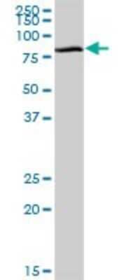 Western Blot: GGA1 Antibody [H00026088-B01P] - Analysis of GGA1 expression in human colon.