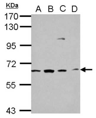 Western Blot: GGA1 Antibody [NBP2-16650] - Sample (30 ug of whole cell lysate) A: NT2D1 B: PC-3 C: U87-MG D: SK-N-SH 7. 5% SDS PAGE gel, diluted at 1:1000.