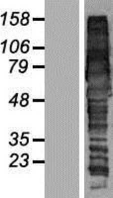 Western Blot: GGA1 Overexpression Lysate (Adult Normal) [NBP2-08986] Left-Empty vector transfected control cell lysate (HEK293 cell lysate); Right -Over-expression Lysate for GGA1.
