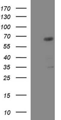 Western Blot: GGA2 Antibody (OTI1D2) - Azide and BSA Free [NBP2-71725] - Analysis of HEK293T cells were transfected with the pCMV6-ENTRY control (Left lane) or pCMV6-ENTRY GGA2.