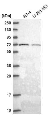 Western Blot GGA2 Antibody