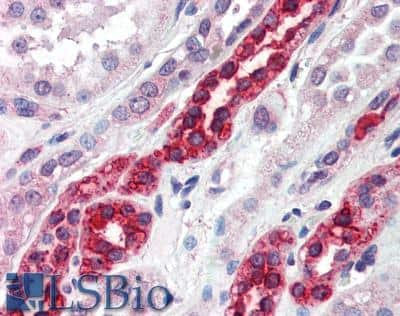 Immunohistochemistry-Paraffin GGA3 Antibody