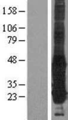 Western Blot: GGCT Overexpression Lysate (Adult Normal) [NBP2-06360] Left-Empty vector transfected control cell lysate (HEK293 cell lysate); Right -Over-expression Lysate for GGCT.