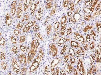 Immunohistochemistry-Paraffin: GGT1 Antibody [NBP2-98438] - Immunochemical staining of rat GGT1 in rat kidney with rabbit polyclonal antibody (1:10000, formalin-fixed paraffin embedded sections).