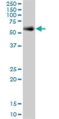 Western Blot: GGT1 Antibody [H00002678-B01P] - GGT1 MaxPab polyclonal antibody. Western Blot analysis of GGT1 expression in A-549.