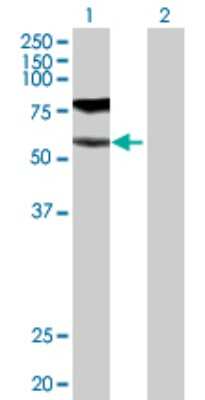 Western Blot: GGT1 Antibody [H00002678-D01P] - Analysis of GGT1 expression in transfected 293T cell line by GGT1 polyclonal antibody.Lane 1: GGT1 transfected lysate(61.40 KDa).Lane 2: Non-transfected lysate.