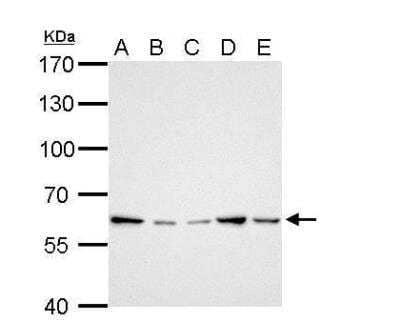 Western Blot: GGT1 Antibody [NBP1-32412] - A. 30 ug Neuro2A whole cell lysate/extract B. 30 ug GL261 whole cell lysate/extract C. 30 ug C8D30 whole cell lysate/extract D. 30 ug NIH-3T3 whole cell lysate/extract E. 30 ug Raw264.7 whole cell lysate/extract F. 30 ug C2C12 whole cell lysate/extract7.5% SDS-PAGE GGT1 antibody dilution: 1:1000 The HRP-conjugated anti-rabbit IgG antibody (NBP2-19301) was used to detect the primary antibody.