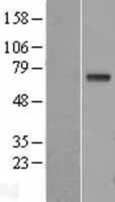 Western Blot: GGT1 Overexpression Lysate (Adult Normal) [NBL1-11060] Left-Empty vector transfected control cell lysate (HEK293 cell lysate); Right -Over-expression Lysate for GGT1.