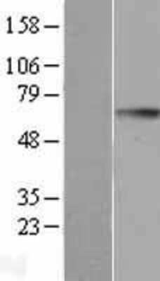 Western Blot: GGT1 Overexpression Lysate (Adult Normal) [NBL1-11061] Left-Empty vector transfected control cell lysate (HEK293 cell lysate); Right -Over-expression Lysate for GGT1.