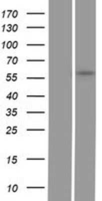Western Blot GGT5 Overexpression Lysate