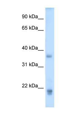 Western Blot: GH2 Antibody [NBP1-59316] - Human Placenta lysate, concentration 5.0ug/ml.